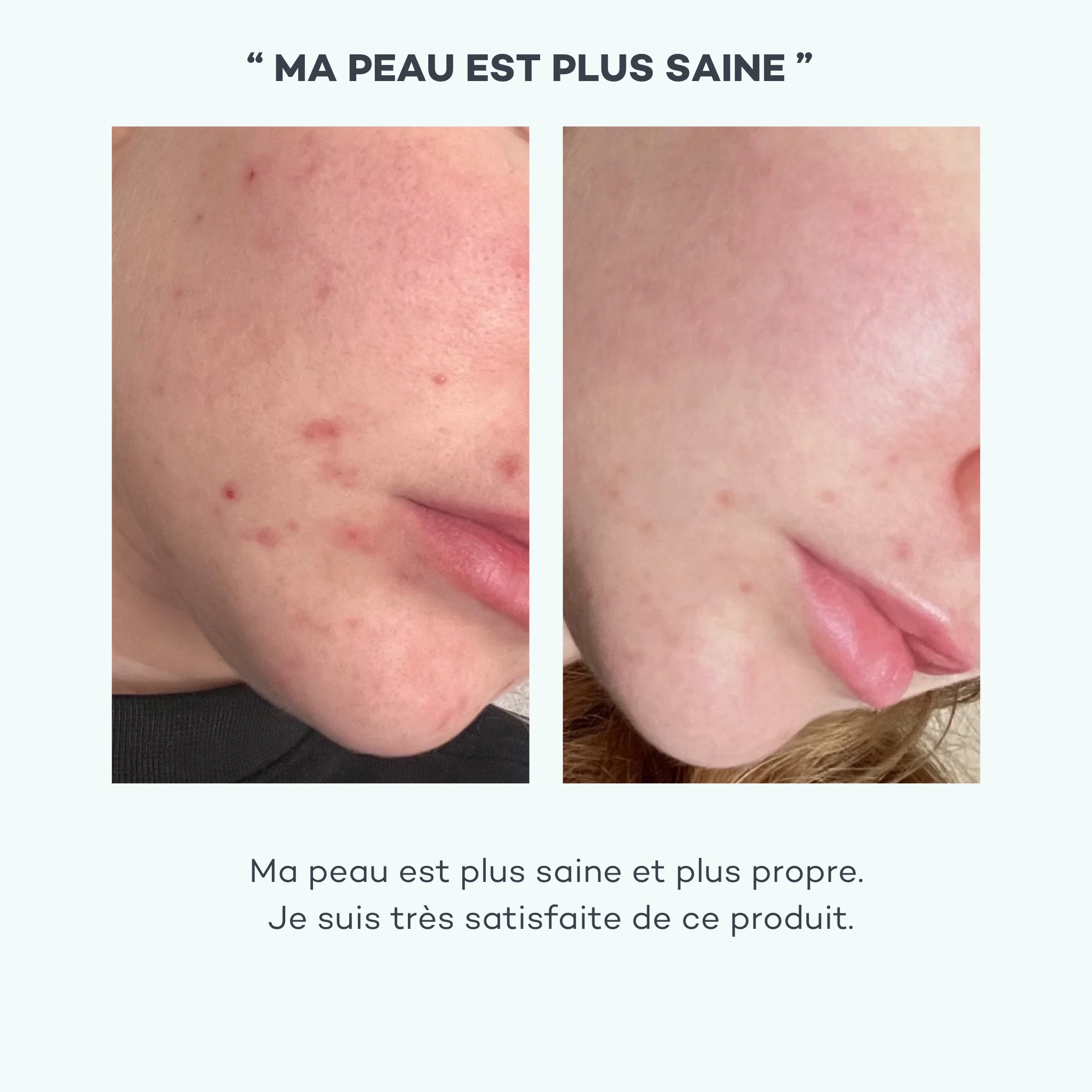 Absolu de Zinc - Image 4