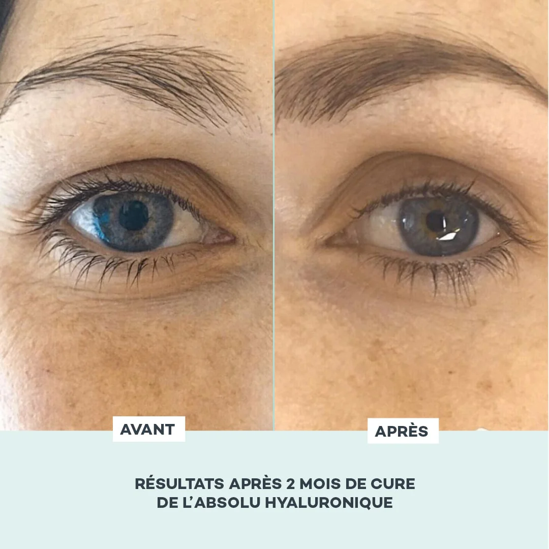 Absolu Hyaluronique - Image 6