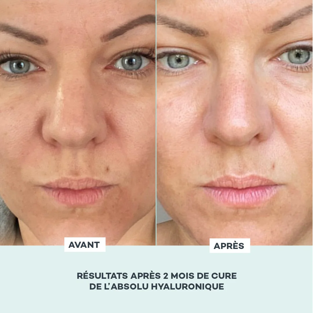 Absolu Hyaluronique - Image 7