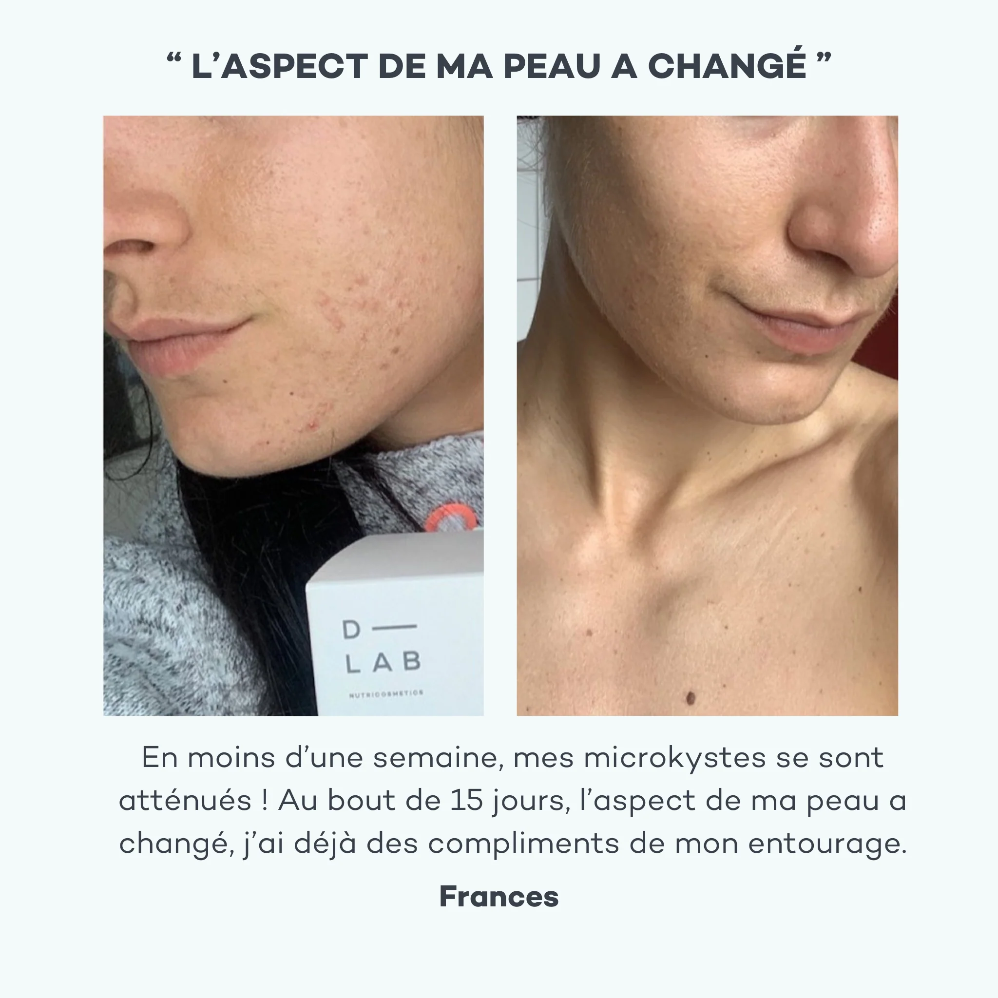 Routine Peau-Parfaite - Image 6