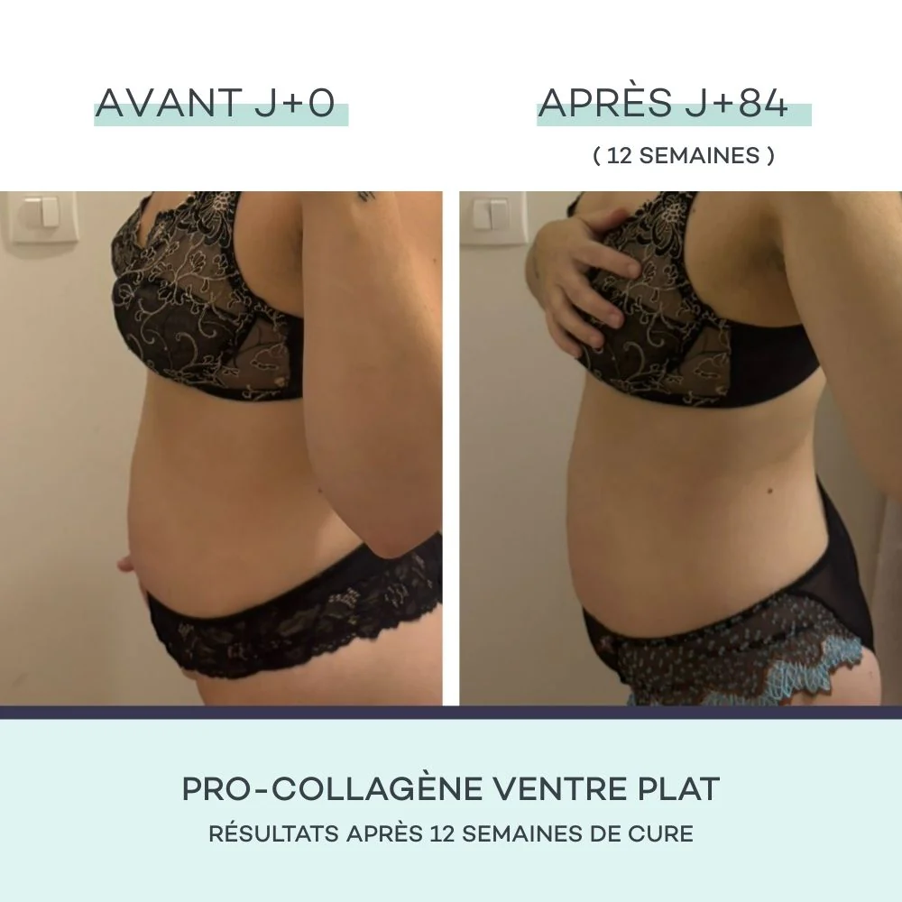 Coffret Minceur - Mangue - Image 8